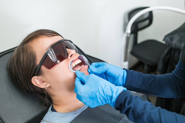 Best Emergency Tooth Extraction in Onalaska, TX